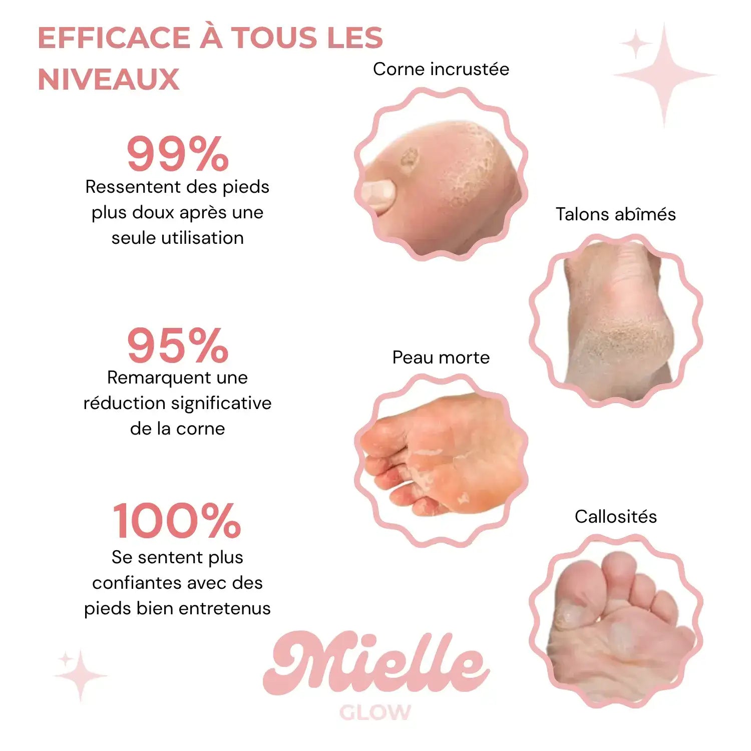 HoneyGlow - Râpe Électrique pour la Beauté des Pieds + 120 Disques OFFERTS