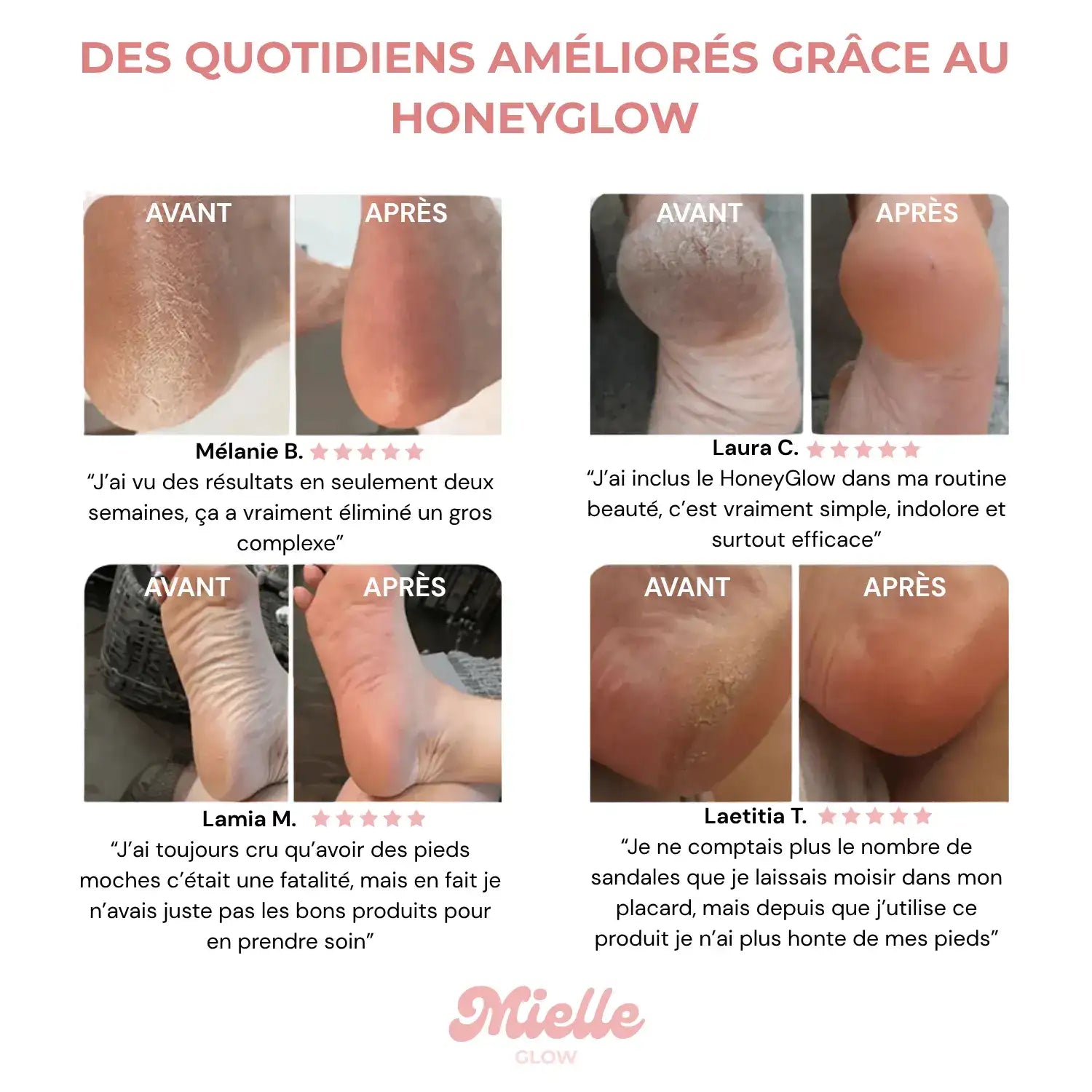 HoneyGlow - Râpe Électrique pour la Beauté des Pieds + 120 Disques OFFERTS